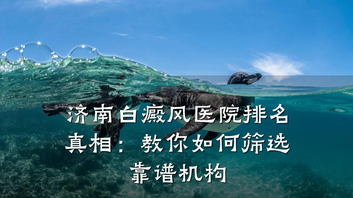 济南白癜风医院排名真相:教你如何筛选靠谱机构
