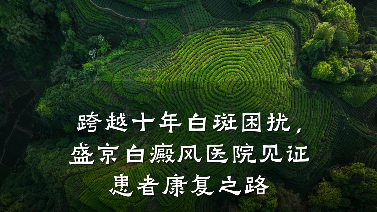 跨越十年白斑困扰,盛京白癜风医院见证患者康复之路