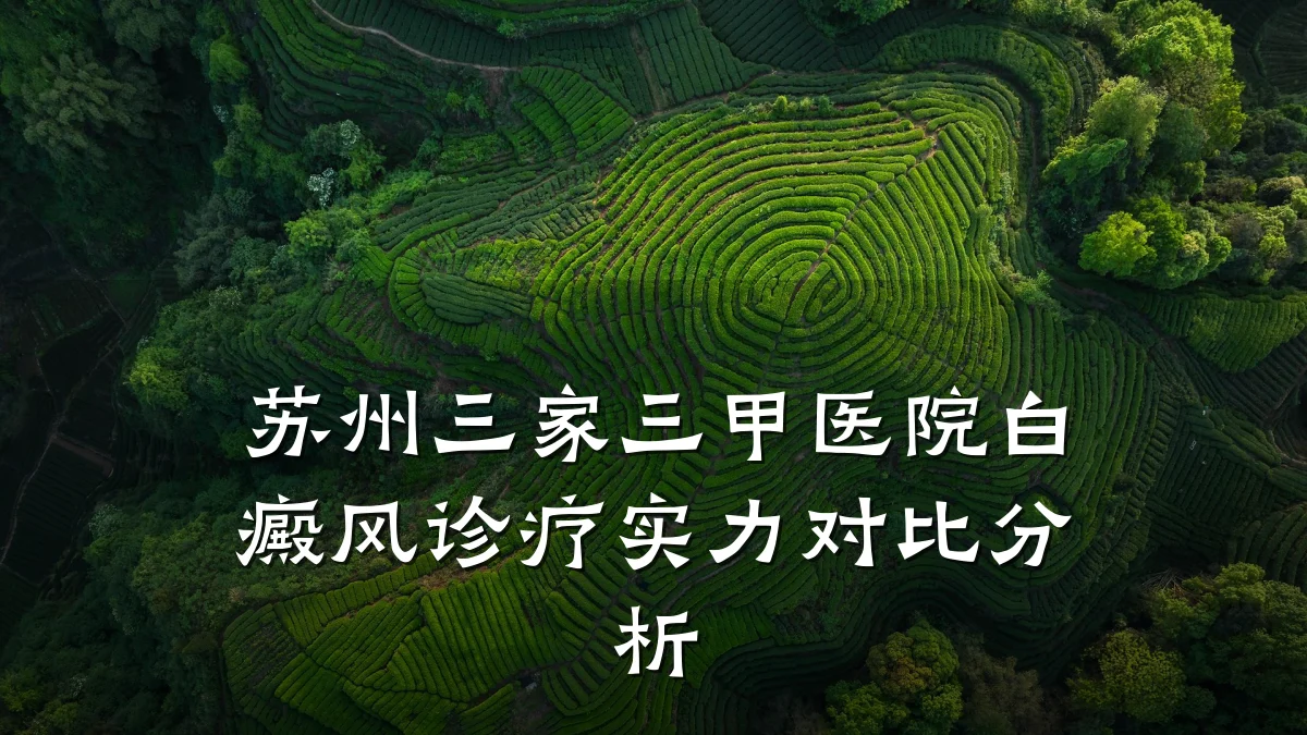 苏州三家三甲医院白癜风诊疗实力对比分析